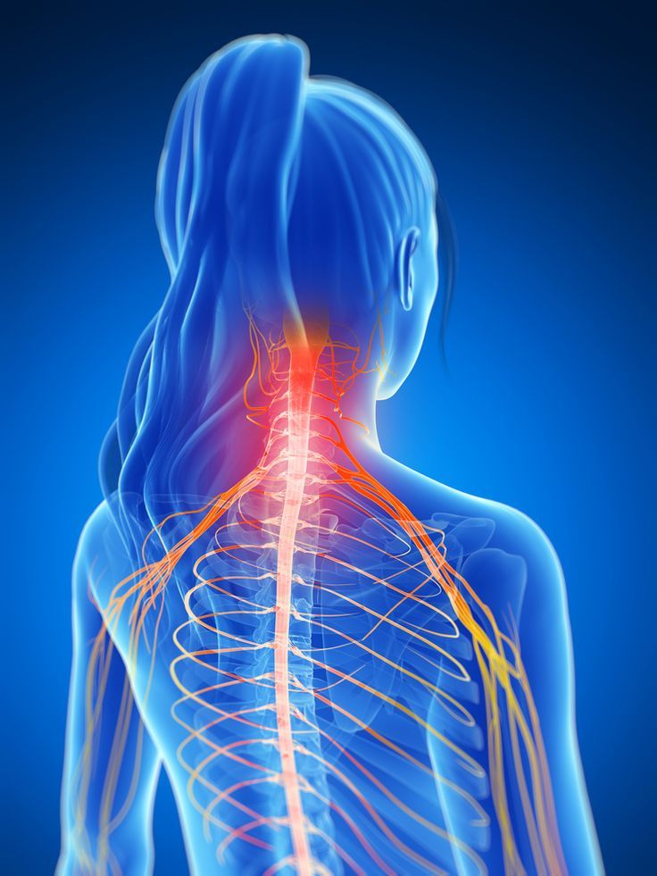Radiculopathy Relief and Treatment